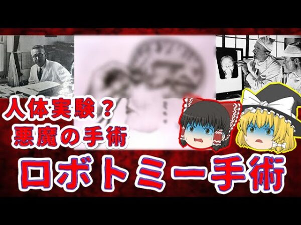 【禁断の医療】悪魔の手術「ロボトミー手術」とは【ゆっくり解説】