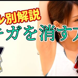 【腋臭症/ワキガ】手術レベルのワキガか確認する方法【ミラドライ】