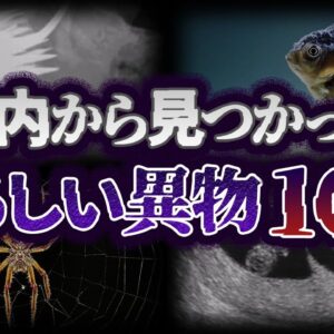 【ゆっくり解説】どうしてこれがここに？人間の体内から発見された異物10選