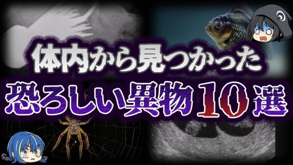 【ゆっくり解説】どうしてこれがここに？人間の体内から発見された異物10選