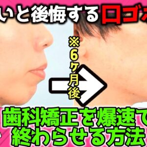 【歯列矯正】これをやったら矯正が1年で終わるらしい【横顔美人】