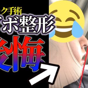 【横顔治すなら顔変えろ】セットバック手術のリアル【口ゴボ】