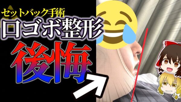 【横顔治すなら顔変えろ】セットバック手術のリアル【口ゴボ】