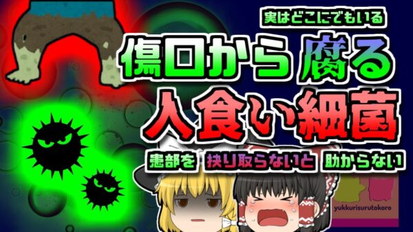 【2016年ｱﾒﾘｶ】傷口を抉り取らなければ助からない 体をゾンビのようにしてしまう「人喰い細菌」【ゆっくり解説】