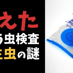 【寄生虫】ぎょう虫検査はなぜ消えた？お尻に潜むヤバい寄生虫とは…