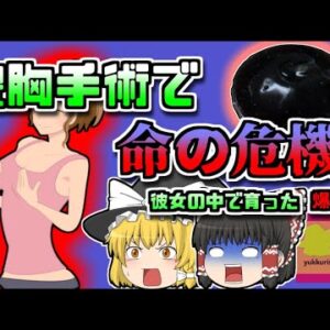 【1989年ｱﾒﾘｶ】胸の中身が腐る?!豊胸手術で起きた悲劇【ゆっくり解説】
