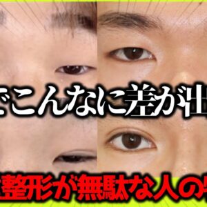 埋没ブスになる人の特徴と治し方【エグすぎる埋没失敗】