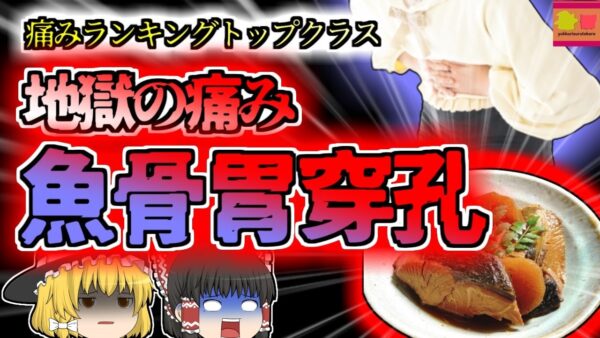 【2016年東京】 大好きなあの和食で胃に穴が？人間が感じる痛みの中でもトップクラスに辛い症状 『魚骨胃壁穿孔事故』【ゆっくり解説】