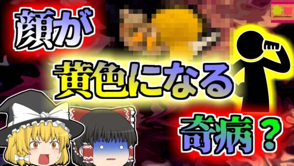 【2016年兵庫】飲み会前によく飲んでおく「アレ」で全身がまっ黄色に変色？意外な肝臓のアレルギー【ゆっくり解説】