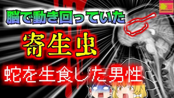 【2017年中国】突然気絶して痙攣を始めた男性 脳から10cm以上ある生きた寄生虫が発見される『マンソン裂頭条虫症』【ゆっくり解説】