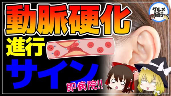 【ゆっくり解説】要注意！動脈硬化の見逃してはいけない危険なサイン【40代50代】