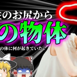 【2011年】女性のお尻から出てきた