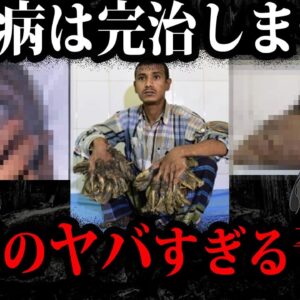 日本人も発症します。実在する怖すぎる奇病７選-2【ゆっくり解説】