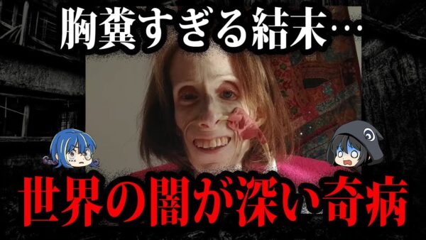 治療不可能！？実在する怖すぎる奇病７選-3【ゆっくり解説】