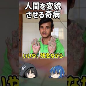 【１分解説】人を変貌させるツリーマン症候群とは？【ゆっくり解説】#shorts