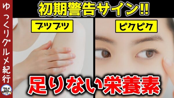 【ゆっくり解説】初期警告！栄養不足を知らせるサイン！あなたに足りない栄養素について