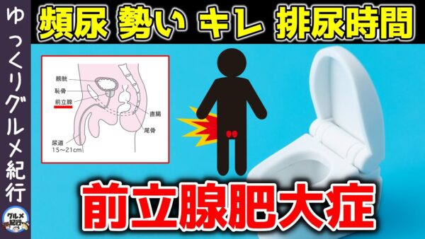 放置厳禁！超意外な前立腺肥大症のリスク！改善予防する方法【ゆっくり解説】