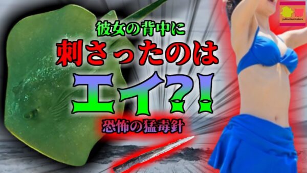 【2023年】「痛っ！クラゲに刺された…？」→巨大なエイの毒針が背中に刺さっていた女性【ゆっくり解説】