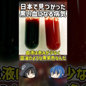 【１分解説】血液が黒く染まる黒血症とは？【ゆっくり解説】#shorts