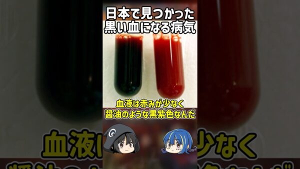 【１分解説】血液が黒く染まる黒血症とは？【ゆっくり解説】#shorts