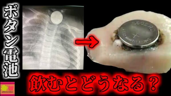 【2021年】飲み込めば10分で肉を溶かす身近で小さな