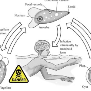 【2023年】天然温泉で遊んだだけなのに....脳がドロドロに溶けてしまう奇病 『脳喰いアメーバ』【ゆっくり解説】