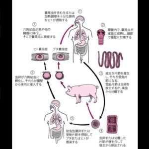 【2014年】患者の口から出てきた 体長190cmの