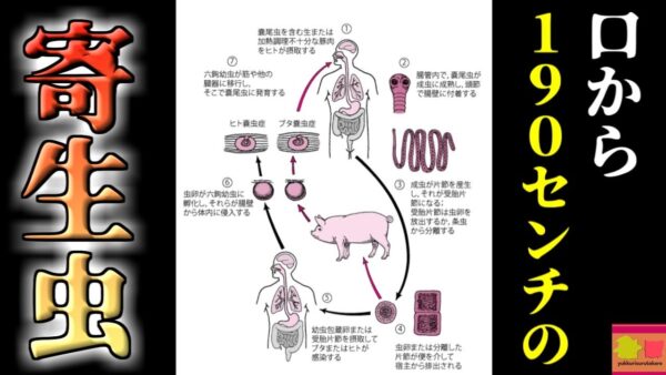 【2014年】患者の口から出てきた 体長190cmの