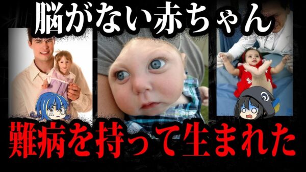 生まれながらに難病…とんでもない姿で生まれた子供たち５選【ゆっくり解説】