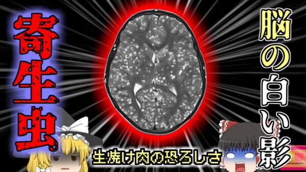 【2019年】謎の頭痛精神錯乱…恐ろしい症状で病院に運ばれた少年 脳が寄生虫だらけになり4亡 原因は生焼けの豚？『インド嚢虫症4亡事故』【ゆっくり解説】