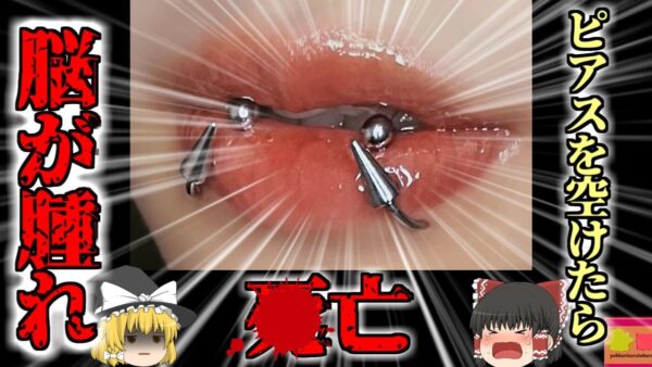 【2022年】女性「安いわね！ここでピアスあけてみよう」→激安違法クリニックの施術で脳が腫れて4亡【ゆっくり解説】