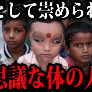 神として崇めれた。不思議な体を持つ人間５選【ゆっくり解説】
