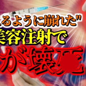 【2016年】鼻が壊4しゾンビのように崩れ落ちた女性モデル 美容医療注射を受けていた彼女の身に何が起こった？『フィラー注射血管閉塞事故』【ゆっくり解説】
