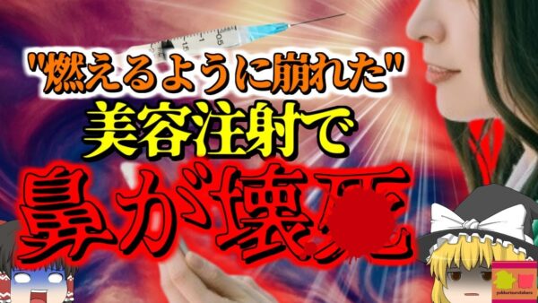 【2016年】鼻が壊4しゾンビのように崩れ落ちた女性モデル 美容医療注射を受けていた彼女の身に何が起こった？『フィラー注射血管閉塞事故』【ゆっくり解説】