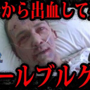 【ゆっくり解説】致死率88%…危険すぎるマールブルグ病