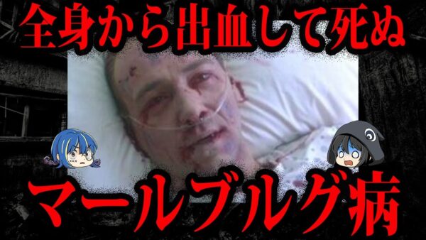 【ゆっくり解説】致死率88%…危険すぎるマールブルグ病