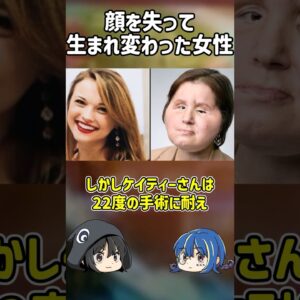 【１分解説】顔を失って生まれ変わった女性を1分解説【ゆっくり解説】#shorts