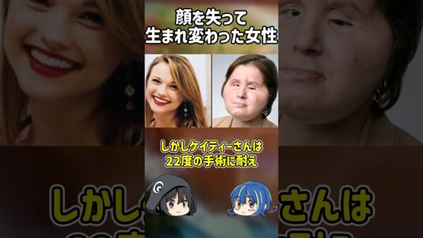 【１分解説】顔を失って生まれ変わった女性を1分解説【ゆっくり解説】#shorts