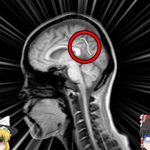 【2014年】原因は「生のカエル」？6年以上悩まされた