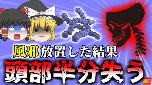 【2021年】「いつもの風邪かなぁ」→脳が溶連菌だらけになり頭蓋骨の半分を失った女性 『副鼻腔炎溶連菌感染症』【ゆっくり解説】