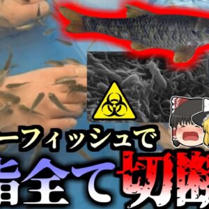 【2010年】綺麗になるハズの”ドクターフィッシュ”で骨を食い尽くすバクテリアに感染 足の指をすべて失ってしまった女性『シュワネラ菌感染症』【ゆっくり解説】