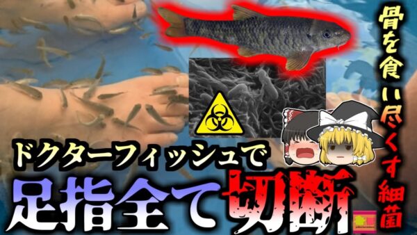 【2010年】綺麗になるハズの”ドクターフィッシュ”で骨を食い尽くすバクテリアに感染 足の指をすべて失ってしまった女性『シュワネラ菌感染症』【ゆっくり解説】