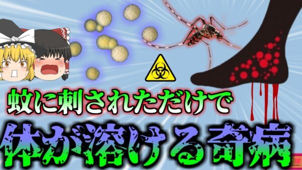 【2016年】”蚊に刺されただけ”　痛みを感じないのに肉が腐り骨が飛び出す奇病…日本でも毎年数名が感染する「ブルーリ潰瘍」これを恐れ出川哲郎氏に鼻ザリガニ禁止令も【ゆっくり解説】