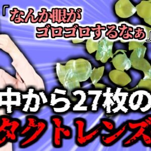 【2017年】眼から27枚のコンタクトレンズ 　女性「ゴロゴロしてたのはドライアイが原因かと思ってた…」【ゆっくり解説】
