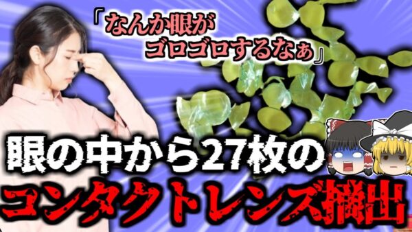 【2017年】眼から27枚のコンタクトレンズ 　女性「ゴロゴロしてたのはドライアイが原因かと思ってた…」【ゆっくり解説】