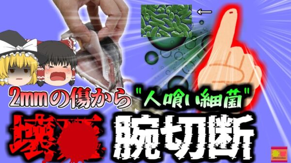 【2021年】たった2mmの傷が原因で腕が腐る…”ヒト喰いバクテリア”『ビブリオ・バルニフィカス』【ゆっくり解説】