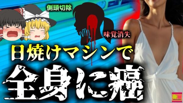 【2021年】『私の病気を見て!!』女学生時代週4で日焼けベッドを使用していた主婦 皮膚がんを発症し全身に転移して亡くなる【ゆっくり解説】