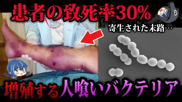 【ゆっくり解説】致死率30％の危険生物！？人間に寄生する寄生虫５選