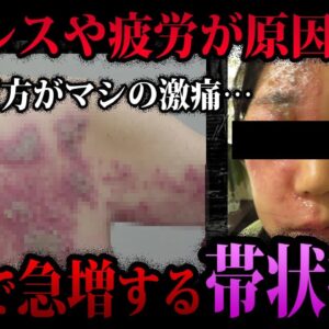 【ゆっくり解説】ストレスで発症率急増中！？日本で増加する帯状疱疹