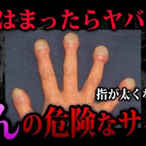 【ゆっくり解説】あてはまったらすぐに病院に！知らないとヤバイがんのサイン５選